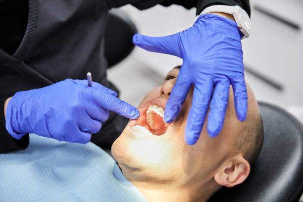Best Emergency Wisdom Teeth Removal in Goldens Bridge, NY