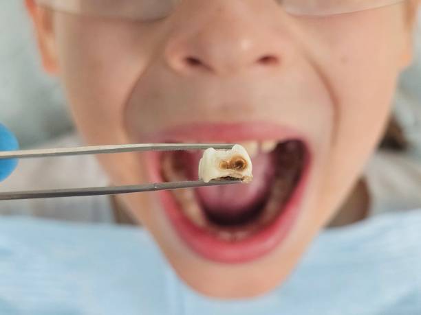 Best Emergency Treatment for Toothache in Goldens Bridge, NY